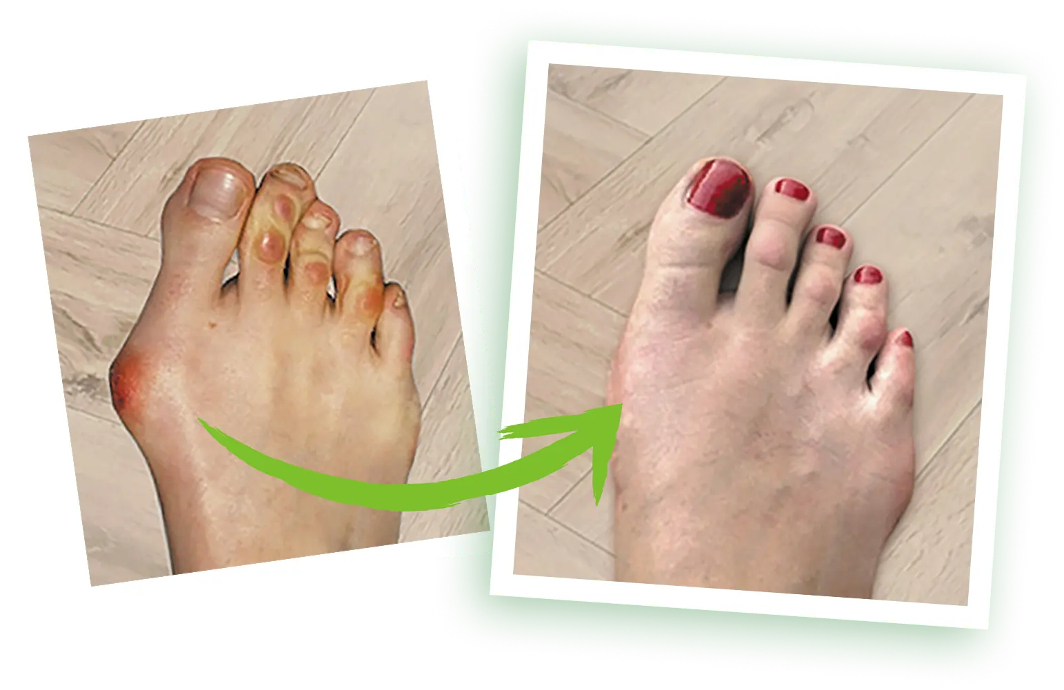 after and before